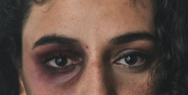 גרם לשברים ועקירה בפניה של גרושתו – ולא נשלח למאסר בפועל