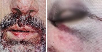 אישום: נהג תקף באופן קשה נהג אחר בעקבות תאונת דרכים