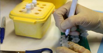 מוריש זרע אחד, שתי נשים – ושאלות משפטיות ומוסריות כבדות משקל