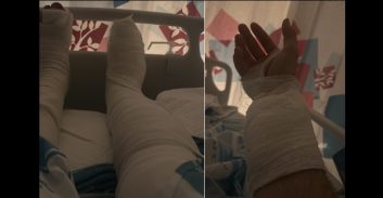 פקיד בנק שנורה בביתו בעוספיה: "אני בטוח שמדובר בטעות בזיהוי"