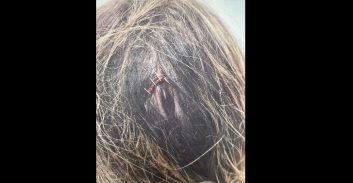 העונש לצעיר שהיכה את חברתו בת ה-14 ואיים: "חכי את נרצחת"