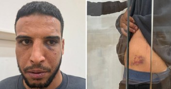 מח"ש תבדוק תלונת נכה שנעצר על תקיפת קצין וטוען למעצר אלים