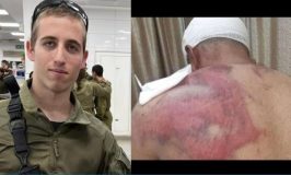 אחרי יותר משנה: שחרור בפיקוח אלקטרוני לנאשם בתקיפה וחטיפת פלסטיני בבקעה