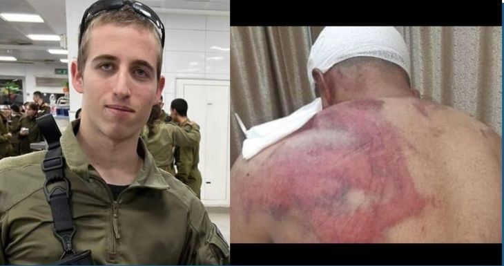 אופיר סער פלשתיני שהותקף - חיצוני