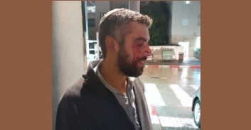 יפו: חשד לתקיפה על רקע גזעני של רב בישיבת הסדר בעיר