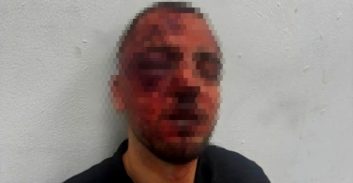 הפרקליט שנעצר בחשד לתקיפת שוטרים: "התנהגו אליי כאל אחרון העבריינים"