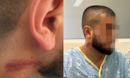 השוטרים: הותקפנו. השופט: החשוד מולי חבול, זה לא מתיישב עם הדוחות