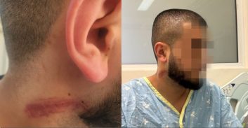 השוטרים: הותקפנו. השופט: החשוד מולי חבול, זה לא מתיישב עם הדוחות