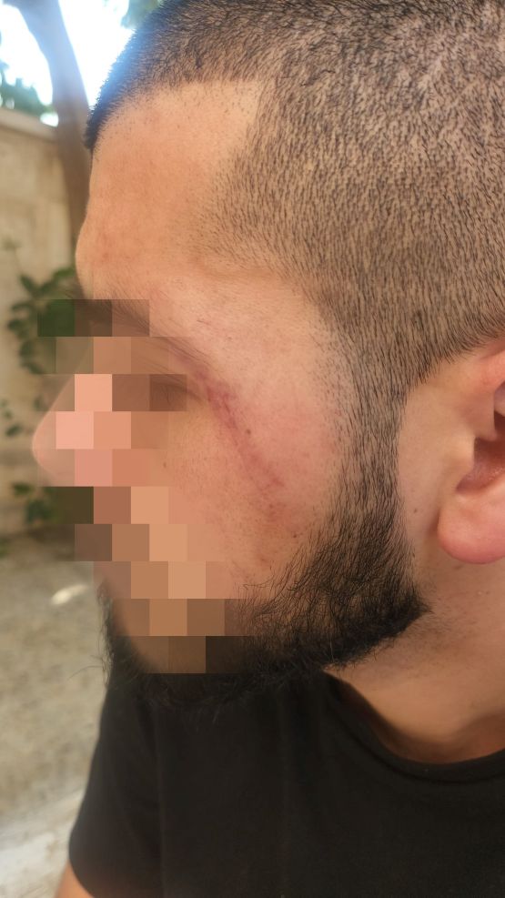 התנגד שייכנסו בלי צו והותקף על ידי שוטרים חורה